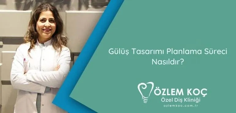 Gülüş Tasarımı Planlama Süreci Nasıldır?
