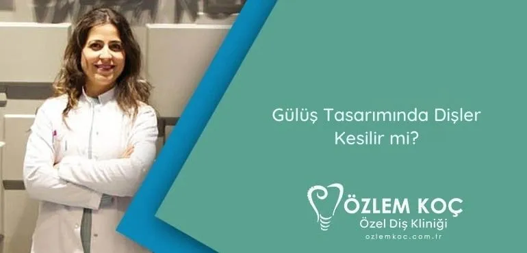 Gülüş Tasarımında Dişler Kesilir mi?